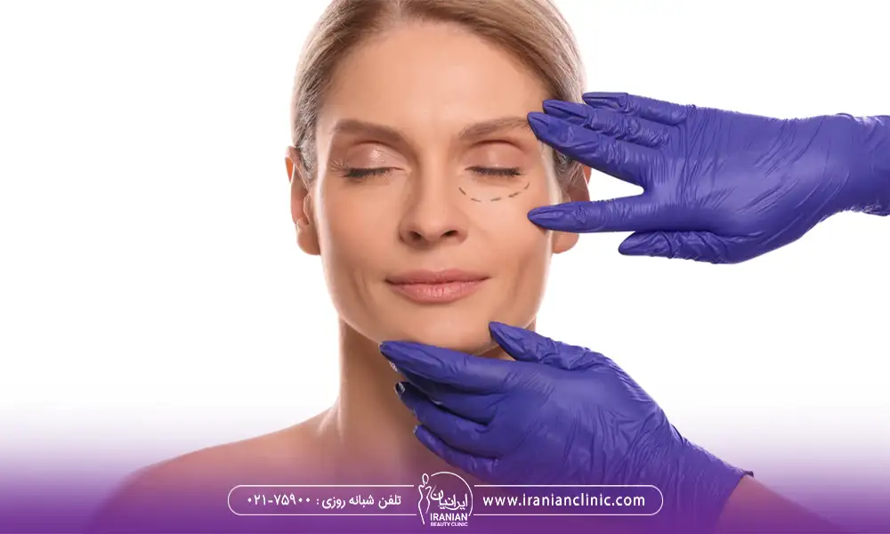 پزشک در حال معاینه قبل از جراحی پلک پایین یک خانم | بوتاکس بعد از بلفاروپلاستی