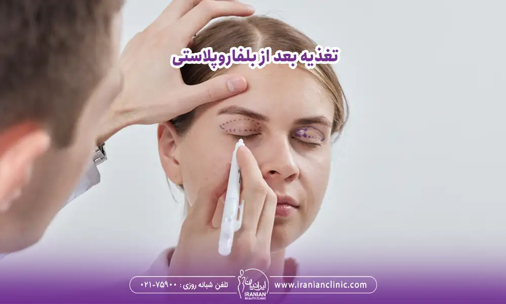 خانمی که چشم های خود برا برای خط کشی قبل از عمل پلک بسته است | مراقبت بعد از بلفاروپلاستی