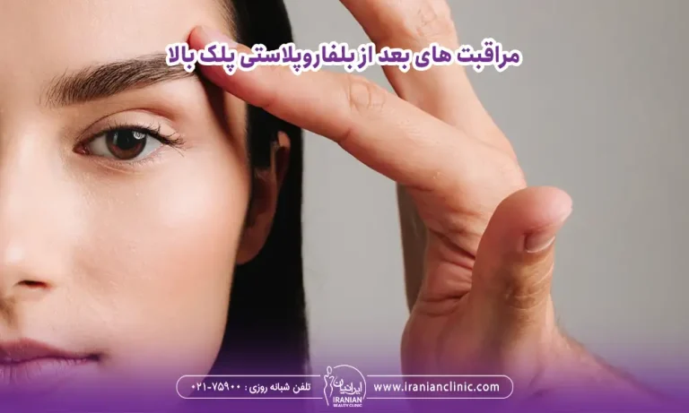 پزشک درحال چک کردن پلک بالای یک خانم بعد از بلفارو برای مراقبت بعد از بلفاروپلاستی