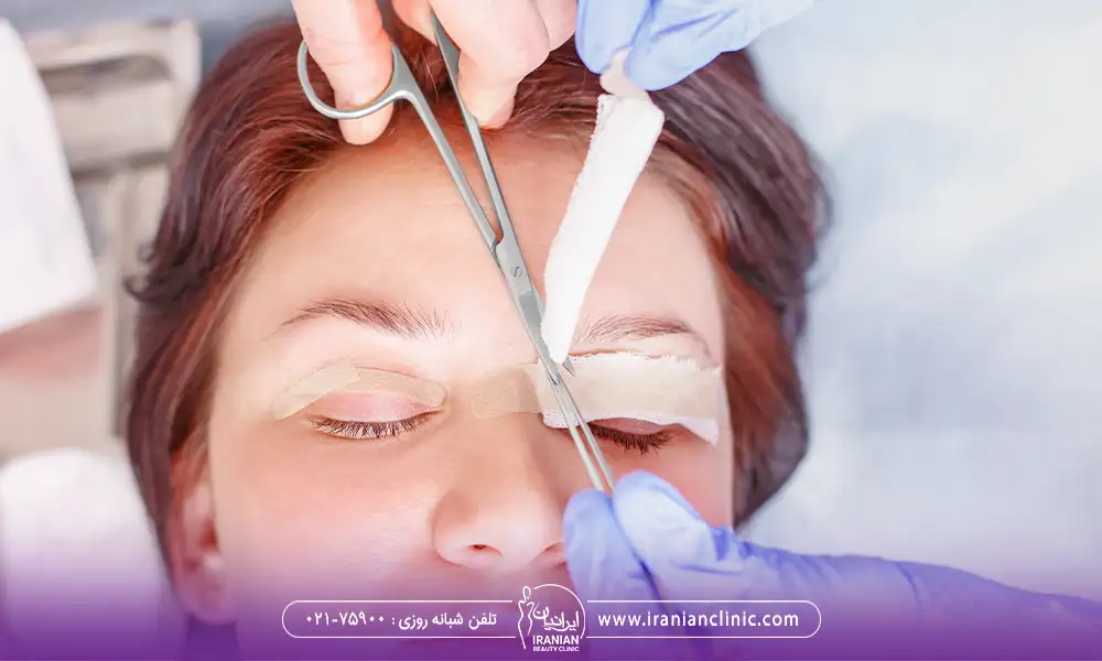 پانسمان روی پلک های یک خانم بعد از جراحی پلک | ماندگاری بلفاروپلاستی