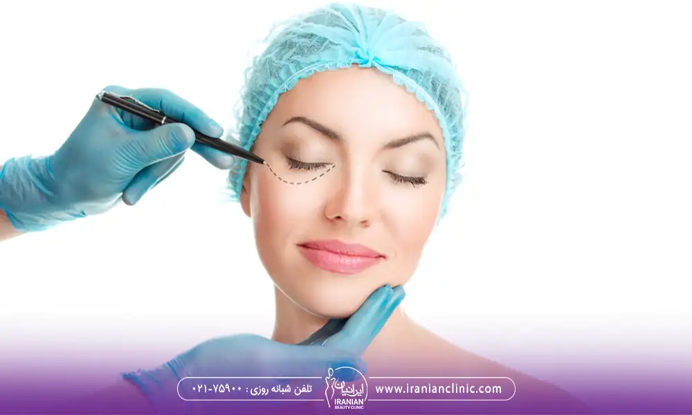 خط مشیدن و مشخص کردن ناحیه عمل پلک پایین | گوشت اضافه بعد از عمل بلفاروپلاستی