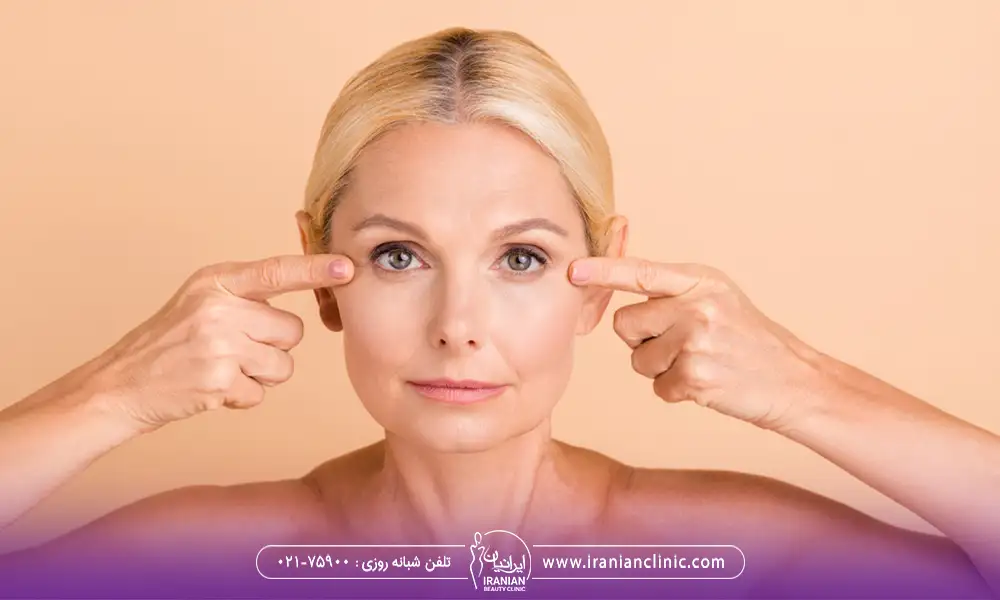 بهترین سن برای عمل بلفاروپلاستی با خانمی که موهای طلایی دارد.