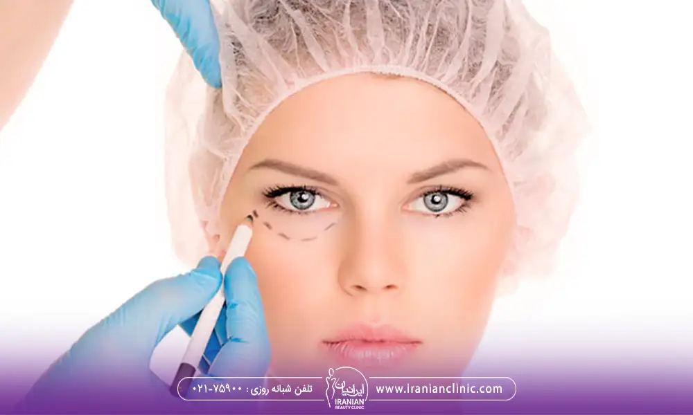 آماده کردن یک خانم برای جراحی پلک در کلینیک بلفاروپلاستی در تهران