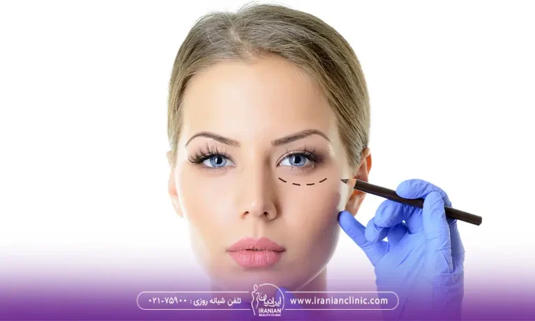 مشخص کردن پلک پایین برای عمل پلک | ماندگاری بلفاروپلاستی
