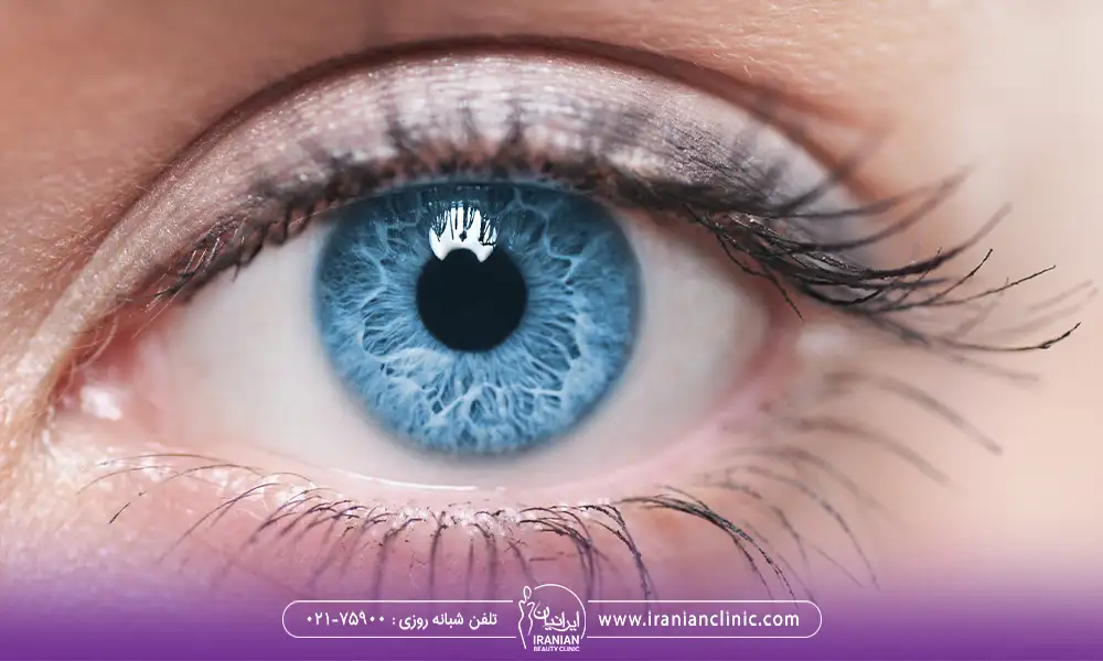 عمل درشت کردن چشم برای چشم های آبی رنگ یک خانم