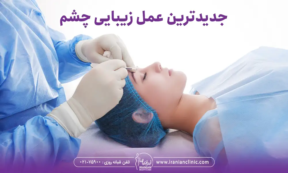 انجام جدیدترین عمل زیبایی چشم
