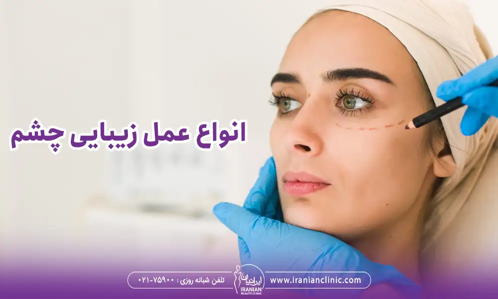 خط کشدن نقاط عمل زیبایی چشم 