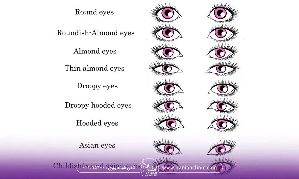 انواع چشم