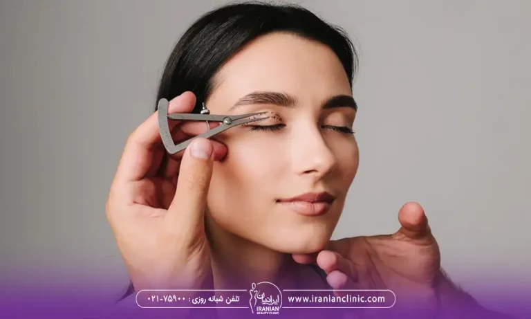 بهترین جراح پلک برای انجام بلفاروپلاستی